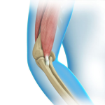 Elbow Tendon and Ligament Repair