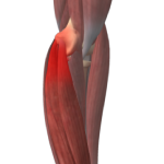 Golfer’s Elbow