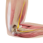 Ulnar Nerve Transposition